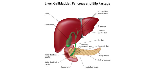 Gallstone Diagram